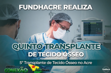 Fundhacre realiza quinto transplante de tecido ósseo e amplia oferta de alta complexidade no Acre