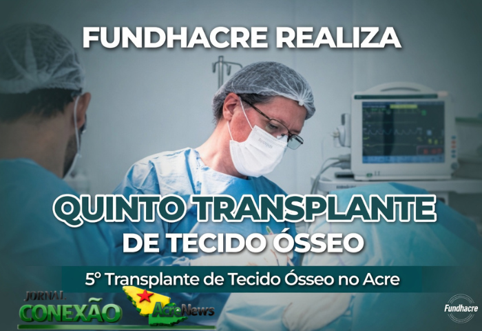 Fundhacre realiza quinto transplante de tecido ósseo e amplia oferta de alta complexidade no Acre